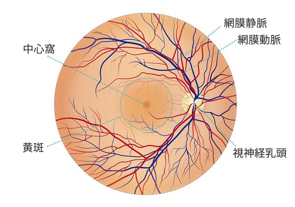 糖尿病網膜症画像1